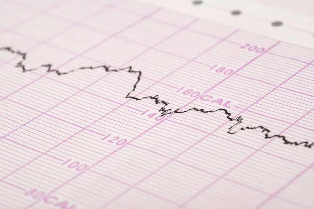 КТГ (сердцебиение плода)