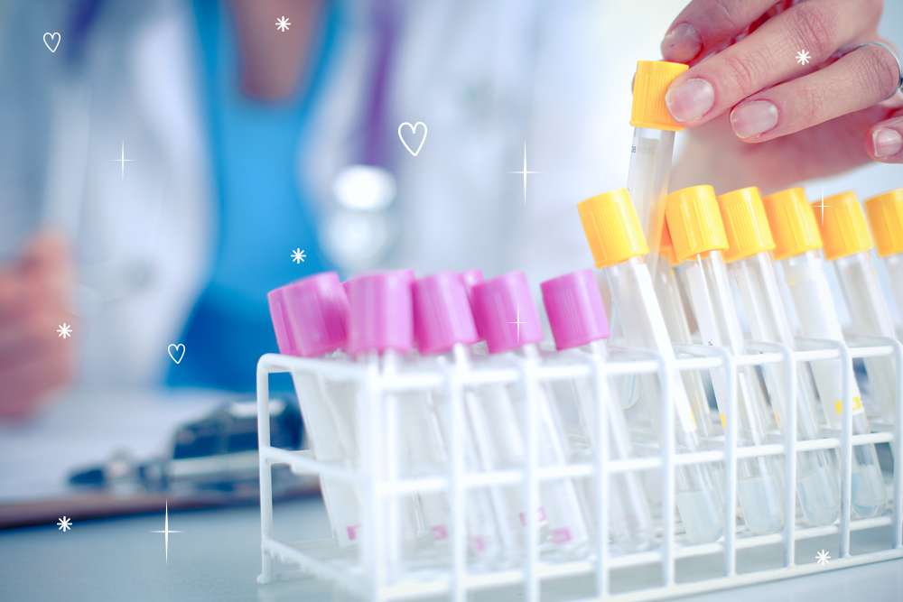 Фосфатаза кислая (КФ, Acid phosphatase, ACP)