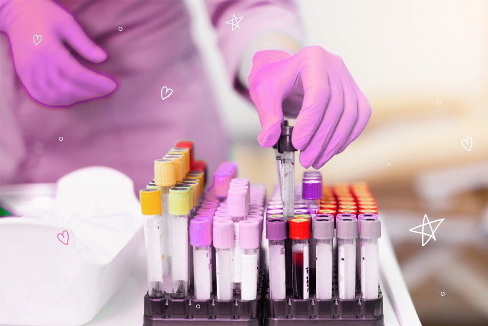 Аполипопротеин А1 (Apolipoprotein A-1)
