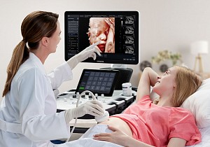 3D УЗИ при беременности: когда лучше делать